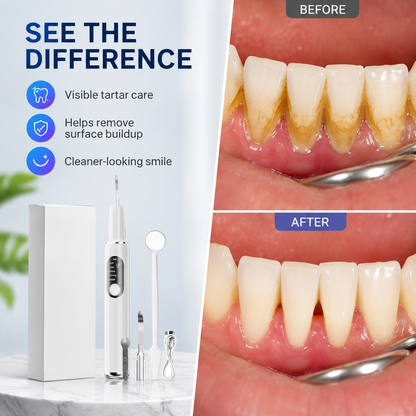 Portable Ultrasonic Teeth Cleaner and Tartar Remover Set